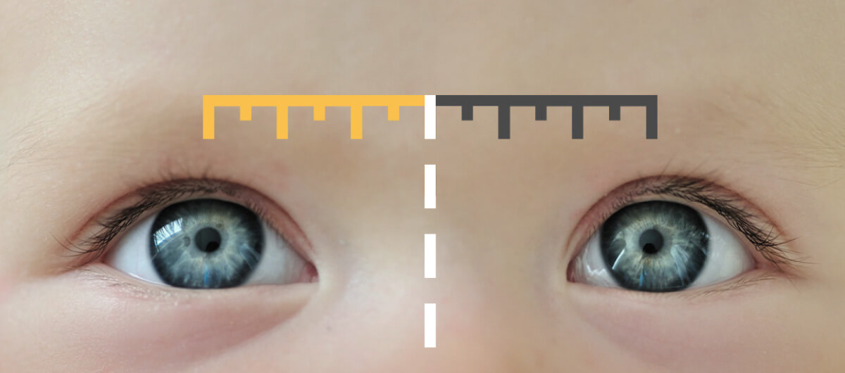 Monocular PD  measures the center of the pupil of the right eye to the center of the nose and then repeat with left eye